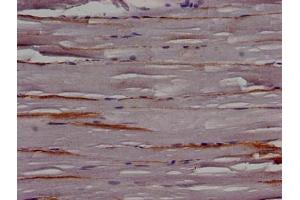 Immunohistochemistry (IHC) image for anti-Eukaryotic Translation Initiation Factor 3, Subunit I (EIF3I) (AA 276-486) antibody (ABIN7147218)
