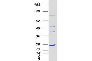 Western Blotting (WB) image for NFKB Inhibitor Interacting Ras-Like 1 (NKIRAS1) protein (Myc-DYKDDDDK Tag) (ABIN2727346)