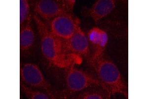 Immunofluorescence staining of methanol-fixed MCF-7 cells using Phospho-KDR-Y1175 antibody (ABIN2988109). (VEGFR2/CD309 Antikörper  (pTyr1175))