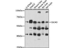 Western blot analysis of extracts of various cell lines, using SSC4D antibody (ABIN7270158) at 1000 dilution. (SRCRB4D Antikörper  (AA 446-575))