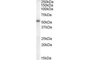 Western Blotting (WB) image for anti-Cytochrome P450, Family 19, Subfamily A, Polypeptide 1 (CYP19A1) (Internal Region) antibody (ABIN238672)
