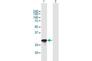 Western Blot analysis of RAB26 expression in transfected 293T cell line by RAB26 MaxPab polyclonal antibody. (RAB26 Antikörper  (AA 1-256))