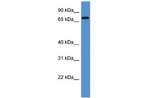 WB Suggested Anti-Angel1 Antibody Titration: 0. (ANGEL1 Antikörper  (C-Term))