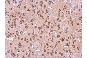 IHC-P Image LYRIC antibody [N2C3] detects LYRIC protein at cytosol on mouse fore brain by immunohistochemical analysis. (MTDH Antikörper)
