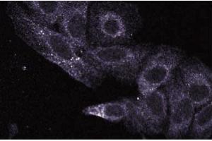 Immunofluorescence staining of HeLa cells (Human cervical epitheloid carcinoma, ATCC CCL-2. (UBE2L3 Antikörper  (AA 15-133))