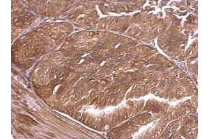 Immunohistochemistry (IHC) image for anti-Adducin 1 (Alpha) (ADD1) antibody (ABIN2855094)
