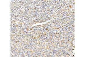 IHC analysis of EIF3E using anti-EIF3E antibody (ABIN7600190).