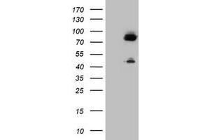 Image no. 1 for anti-Coagulation Factor XIII, A1 Polypeptide (F13A1) antibody (ABIN1498154) (F13A1 Antikörper)