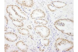 Immunohistochemistry (IHC) image for anti-General Transcription Factor IIIC, Polypeptide 5 (GTF3C5) (AA 469-519) antibody (ABIN7448588)