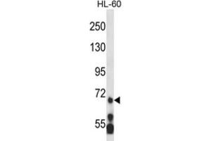Western Blotting (WB) image for anti-Myeloid/lymphoid Or Mixed-Lineage Leukemia 5 (Trithorax Homolog) (MLL5) antibody (ABIN2995217) (MLL5/KMT2E Antikörper)