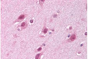 Human Brain, Cortex (formalin-fixed, paraffin-embedded) stained with HUWE1 antibody ABIN213933 at 5 ug/ml followed by biotinylated goat anti-rabbit IgG secondary antibody ABIN481713, alkaline phosphatase-streptavidin and chromogen. (HUWE1 Antikörper  (C-Term))