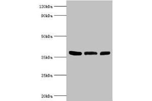 Western Blotting (WB) image for anti-Arginase, Type II (ARG2) (AA 1-354) antibody (ABIN7144586)