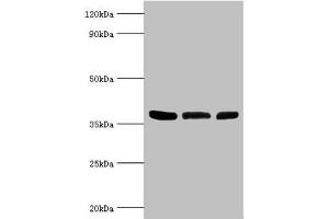 Western blot All lanes: ARG2 antibody at 5 μg/mL Lane 1: Mouse liver tissue Lane 2: 293T whole cell lysate Lane 3: Mouse kidney tissue Secondary Goat polyclonal to rabbit IgG at 1/10000 dilution Predicted band size: 39 kDa Observed band size: 39 kDa (ARG2 Antikörper  (AA 1-354))