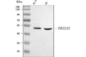 anti-Protease, serine, 35 (PRSS35) (AA 30-340) antibody