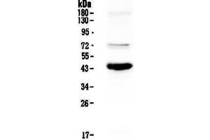 Western blot analysis of PAX5 using anti-PAX5 antibody .
