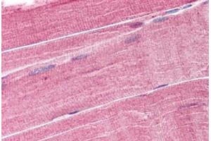 Human Skeletal Muscle (formalin-fixed, paraffin-embedded) stained with TRIM63 antibody ABIN293523 at 1. (TRIM63 Antikörper  (AA 2-14))