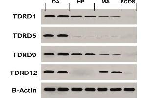 Western blotting test results for protein expression of TDRDs genes in HP, MA, SCOS, and OA samples compared to control group Source: PMID32059713 (TDRD1 Antikörper  (AA 837-968))