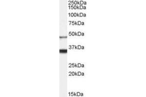AP31067PU-N HCRTR1 antibody staining of Human Brain lysate at 0. (HCRTR1 Antikörper  (Internal Region))