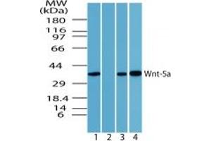 Image no. 1 for anti-Wingless-Type MMTV Integration Site Family, Member 5A (WNT5A) (AA 190-230) antibody (ABIN207746) (WNT5A Antikörper  (AA 190-230))