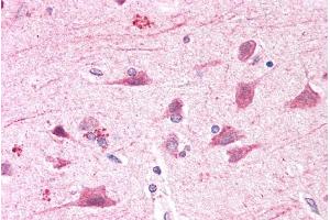 ABIN2613396 (5µg/ml) staining of paraffin embedded Human Cortex. (BOD1L1 Antikörper  (AA 2802-2815))