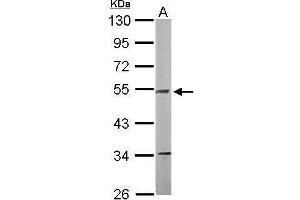 Western Blotting (WB) image for anti-NADH Dehydrogenase (Ubiquinone) Flavoprotein 1, 51kDa (NDUFV1) (Center) antibody (ABIN2855323)