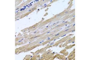 Immunohistochemistry of paraffin-embedded rat heart using NSF antibody at dilution of 1:100 (x40 lens).