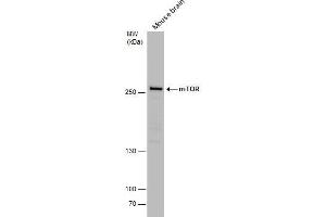 Western Blotting (WB) image for anti-Mechanistic Target of Rapamycin (serine/threonine Kinase) (mTOR) (C-Term) antibody (ABIN2855088)