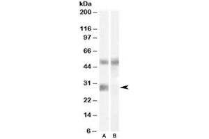 Western blot testing of human breast cancer lysate with IGFBP3 antibody at 0. (IGFBP3 Antikörper)