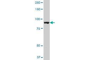 ALDH1L1 polyclonal antibody (A01), Lot # PUM4060503QCS1. (ALDH1L1 Antikörper  (AA 803-902))