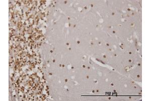 Immunoperoxidase of monoclonal antibody to EN1 on formalin-fixed paraffin-embedded human cerebellum. (EN1 Antikörper  (AA 266-392))