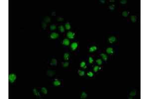 Immunofluorescence staining of Hela cells with ABIN7149505 at 1:200, counter-stained with DAPI. (APPL2 Antikörper  (AA 399-512))