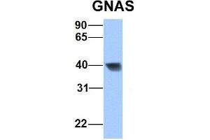 Western Blotting (WB) image for anti-GNAS Complex Locus (GNAS) (N-Term) antibody (ABIN2775543)