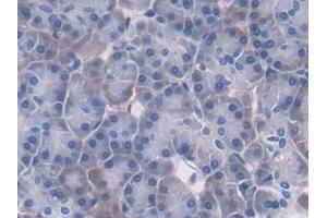 Detection of PTPRB in Human Pancreas Tissue using Polyclonal Antibody to Protein Tyrosine Phosphatase Receptor Type B (PTPRB)