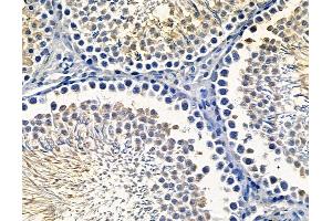 ABIN7096741 and ABIN7100806 at 1/100 staining rat testis tissue by IHC-P.