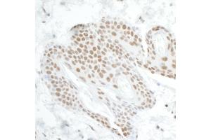 anti-DEAD (Asp-Glu-Ala-Asp) Box Polypeptide 5 (DDX5) (C-Term) antibody