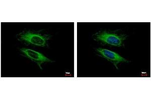 ICC/IF Image VPS11 antibody detects VPS11 protein at cytoplasm by immunofluorescent analysis.