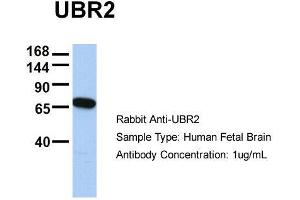 Host:  Rabbit  Target Name:  UBR2  Sample Type:  Human Fetal Brain  Antibody Dilution:  1. (UBR2 Antikörper  (C-Term))