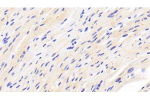 Immunohistochemistry (IHC) image for anti-Fibronectin Type III Domain Containing 5 (FNDC5) (AA 77-144) antibody (ABIN7438583)