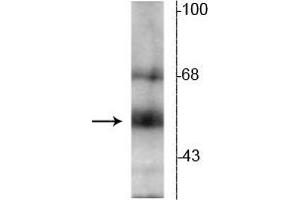 Western blot of hippocampal lysate showing specific immunolabeling of the ~55 kDa TR-β protein. (THRB Antikörper  (N-Term))