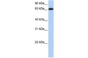 Western Blotting (WB) image for anti-Ectonucleoside Triphosphate diphosphohydrolase 7 (ENTPD7) antibody (ABIN2459295)