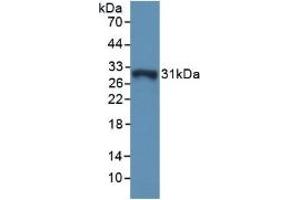 Detection of Recombinant GSTo1, Mouse using Polyclonal Antibody to Glutathione S Transferase Omega 1 (GSTo1)