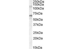 Western Blotting (WB) image for anti-Interleukin-1 Receptor-Associated Kinase 3 (IRAK3) (AA 582-593) antibody (ABIN296287) (IRAK3 Antikörper  (AA 582-593))