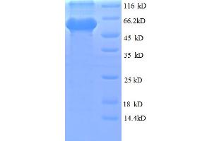 SDS-PAGE (SDS) image for Obg-Like ATPase 1 (OLA1) (AA 1-396), (full length) protein (His-SUMO Tag) (ABIN4975756) (OLA1 Protein (AA 1-396, full length) (His-SUMO Tag))