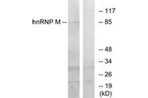 Western Blotting (WB) image for anti-Heterogeneous Nuclear Ribonucleoprotein M (HNRNPM) (AA 11-60) antibody (ABIN2889505) (HNRNPM Antikörper  (AA 11-60))