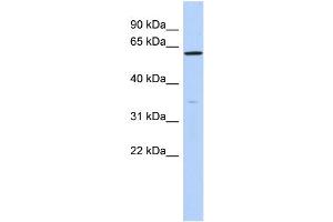 WB Suggested Anti-ZNF431 Antibody Titration:  0. (ZNF431 Antikörper  (N-Term))