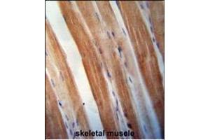 KBTBD5 antibody (Center) (ABIN654387 and ABIN2844133) immunohistochemistry analysis in formalin fixed and paraffin embedded human skeletal muscle followed by peroxidase conjugation of the secondary antibody and DAB staining. (KBTBD5 Antikörper  (AA 349-377))