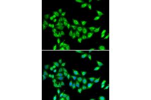 Immunofluorescence analysis of U2OS cells using KIF3A antibody (ABIN5973995). (KIF3A Antikörper)