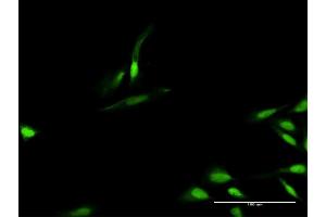 Immunofluorescence of purified MaxPab antibody to TIMELESS on HeLa cell. (TIMELESS Antikörper  (AA 1-1208))