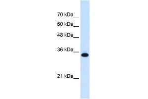 WB Suggested Anti-SLC25A38 Antibody Titration:  0. (SLC25A38 Antikörper  (Middle Region))
