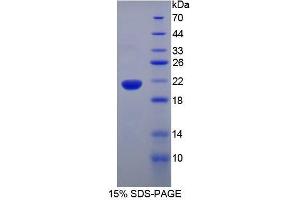 SDS-PAGE (SDS) image for Tumor Necrosis Factor alpha (TNF alpha) (AA 80-235) protein (His tag) (ABIN1878571)